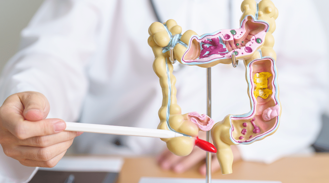 Cancer Colorectal