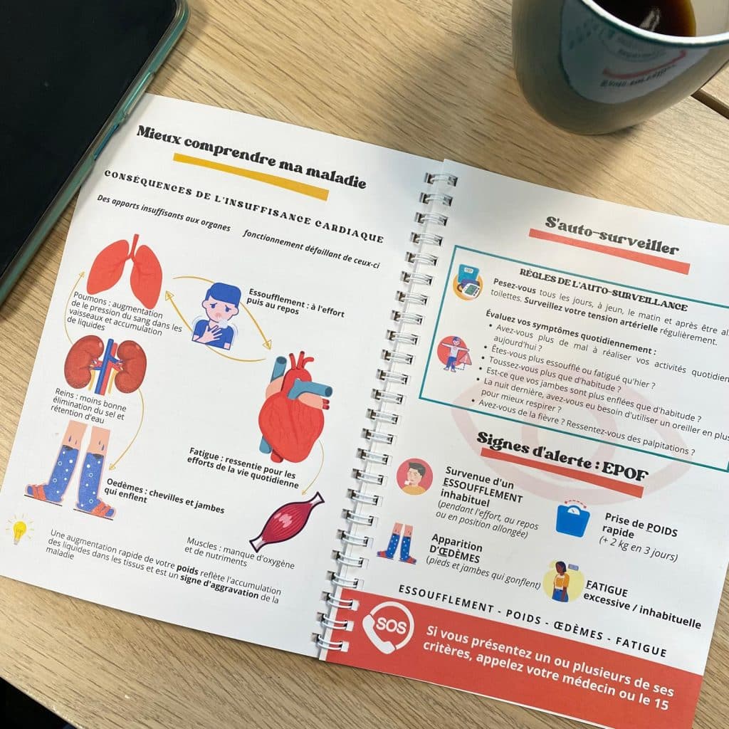 insuffisance cardiaque - formation